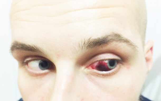 На фото пострадавший